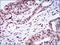 Zinc Finger E-Box Binding Homeobox 1 antibody, NBP2-37329, Novus Biologicals, Immunohistochemistry frozen image 