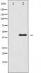 MEK1/2 antibody, TA325633, Origene, Western Blot image 