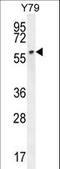 Ligand Dependent Nuclear Receptor Corepressor antibody, LS-C165723, Lifespan Biosciences, Western Blot image 