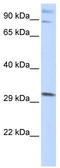 Zinc Finger Protein 148 antibody, TA335485, Origene, Western Blot image 