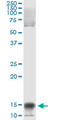 Nuclear Factor Of Activated T Cells 2 Interacting Protein antibody, LS-C139218, Lifespan Biosciences, Immunoprecipitation image 