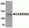 CASK Interacting Protein 2 antibody, NBP2-81971, Novus Biologicals, Western Blot image 