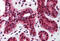 Tumor Protein P73 antibody, MBS241875, MyBioSource, Immunohistochemistry frozen image 
