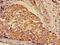 Glutamate-Cysteine Ligase Modifier Subunit antibody, LS-C670232, Lifespan Biosciences, Immunohistochemistry paraffin image 