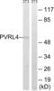 Nectin Cell Adhesion Molecule 4 antibody, LS-C120225, Lifespan Biosciences, Western Blot image 