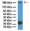 ATP Binding Cassette Subfamily C Member 9 antibody, GTX46867, GeneTex, Western Blot image 