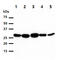 Heme Oxygenase 1 antibody, GTX57699, GeneTex, Western Blot image 