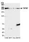 Transient Receptor Potential Cation Channel Subfamily M Member 7 antibody, A302-700A, Bethyl Labs, Western Blot image 