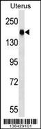 Cingulin Like 1 antibody, 58-820, ProSci, Western Blot image 