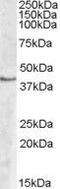 Sphingosine Kinase 1 antibody, PA5-18905, Invitrogen Antibodies, Western Blot image 