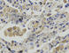 Podoplanin antibody, A7166, ABclonal Technology, Immunohistochemistry paraffin image 