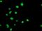 Glycine Amidinotransferase antibody, MA5-25621, Invitrogen Antibodies, Immunocytochemistry image 