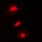 Kinesin Family Member 2C antibody, orb315584, Biorbyt, Immunofluorescence image 