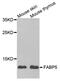 Fatty Acid Binding Protein 5 antibody, PA5-76920, Invitrogen Antibodies, Western Blot image 