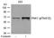 P21 (RAC1) Activated Kinase 1 antibody, GTX50211, GeneTex, Western Blot image 