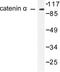 Catenin Alpha 1 antibody, LS-C175943, Lifespan Biosciences, Western Blot image 
