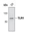 Toll Like Receptor 1 antibody, PA5-17134, Invitrogen Antibodies, Western Blot image 