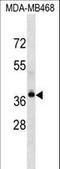 Lysophosphatidic Acid Receptor 4 antibody, LS-C165847, Lifespan Biosciences, Western Blot image 