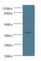 Histone Deacetylase 11 antibody, LS-C375887, Lifespan Biosciences, Western Blot image 