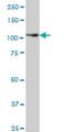 Protein Tyrosine Kinase 7 (Inactive) antibody, H00005754-M06, Novus Biologicals, Western Blot image 