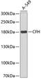 Complement factor H antibody, 15-096, ProSci, Western Blot image 