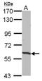 Hyaluronan Binding Protein 2 antibody, NBP2-16775, Novus Biologicals, Western Blot image 