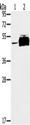 Tyrosine-protein phosphatase non-receptor type 20 antibody, TA351565, Origene, Western Blot image 