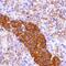 CD99 Molecule (Xg Blood Group) antibody, MA5-16416, Invitrogen Antibodies, Immunohistochemistry paraffin image 