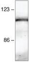 Catenin Beta 1 antibody, 71-2700, Invitrogen Antibodies, Immunoprecipitation image 