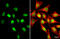 CCAAT Enhancer Binding Protein Beta antibody, GTX100675, GeneTex, Immunofluorescence image 