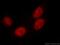Thyroid Hormone Receptor Associated Protein 3 antibody, 19744-1-AP, Proteintech Group, Immunofluorescence image 