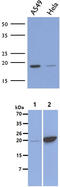 Mitochondrial Ribosomal Protein L58 antibody, MBS200279, MyBioSource, Western Blot image 