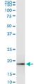 Mitochondrial Ribosomal Protein L58 antibody, H00003396-M05, Novus Biologicals, Western Blot image 