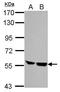Hematopoietic Cell-Specific Lyn Substrate 1 antibody, GTX100303, GeneTex, Western Blot image 