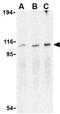 Endoplasmic Reticulum To Nucleus Signaling 2 antibody, ab37073, Abcam, Western Blot image 