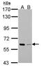 P21 (RAC1) Activated Kinase 1 antibody, GTX103797, GeneTex, Western Blot image 