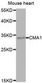 Chymase 1 antibody, LS-C348965, Lifespan Biosciences, Western Blot image 