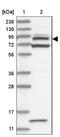 ArfGAP With Coiled-Coil, Ankyrin Repeat And PH Domains 2 antibody, NBP1-84543, Novus Biologicals, Western Blot image 