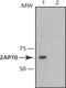 Zeta Chain Of T Cell Receptor Associated Protein Kinase 70 antibody, MA1-21350, Invitrogen Antibodies, Western Blot image 
