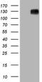 Myocardin Related Transcription Factor A antibody, NBP2-45862, Novus Biologicals, Western Blot image 