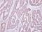 Occludin antibody, GTX114949, GeneTex, Immunohistochemistry paraffin image 