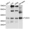 Tumor Suppressor Candidate 3 antibody, STJ114445, St John