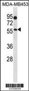 Beta-1,4-N-Acetyl-Galactosaminyltransferase 1 antibody, 59-823, ProSci, Western Blot image 