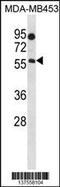 Beta-1,4-N-Acetyl-Galactosaminyltransferase 1 antibody, 59-823, ProSci, Western Blot image 