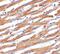 PD-L1 antibody, PA5-20343, Invitrogen Antibodies, Immunohistochemistry paraffin image 