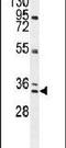 A-Kinase Interacting Protein 1 antibody, PA5-23602, Invitrogen Antibodies, Western Blot image 