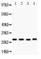 Stanniocalcin 2 antibody, PA1998, Boster Biological Technology, Western Blot image 