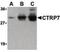 C1q And TNF Related 7 antibody, PA5-20198, Invitrogen Antibodies, Western Blot image 