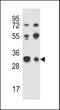 TWIST Neighbor antibody, 61-860, ProSci, Western Blot image 