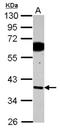 Stromal Cell Derived Factor 4 antibody, NBP2-20276, Novus Biologicals, Western Blot image 